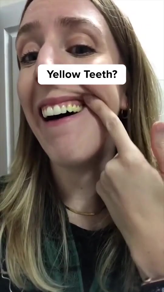 The World's Most Effective Dental Color Corrector