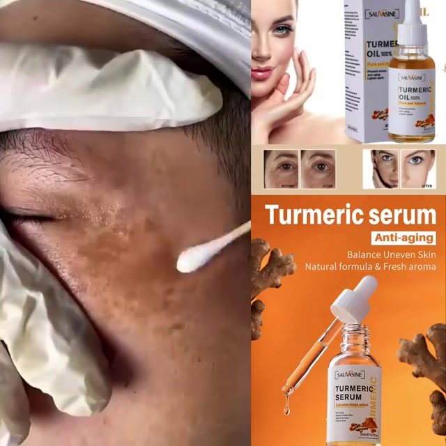 🎉Buy 2 Get 1 Free🎁Turmeric Anti-oxidation Serum